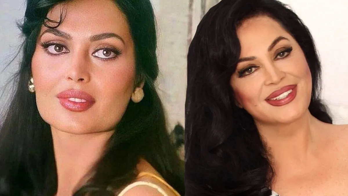 Türkan Şoray ‘Sultan’ olmadan önce yüzü bakın nasıldı… Estetiksiz halini görenler doktorunu tebrik etti!