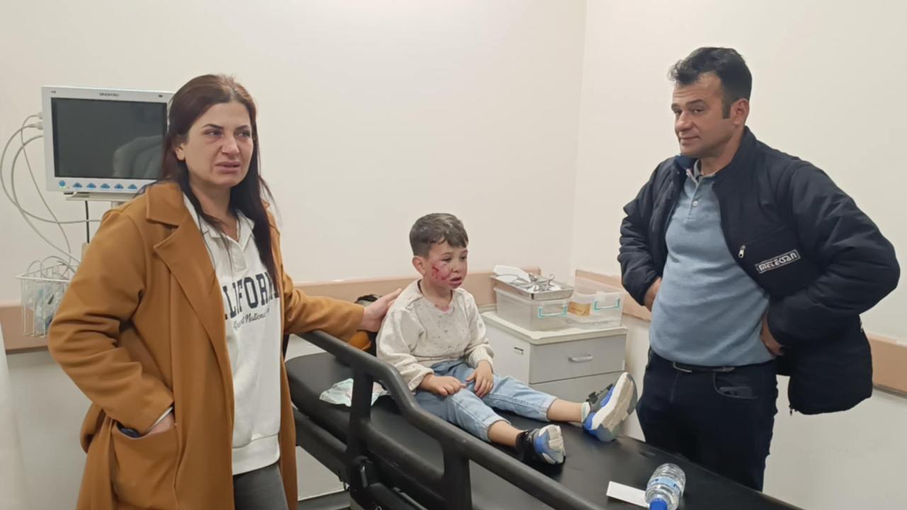 7 yaşındaki çocuk, oyun parkında başıboş köpeğin saldırısına uğradı